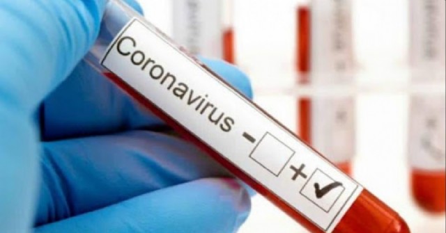 Confirman un nuevo caso de coronavirus en el distrito